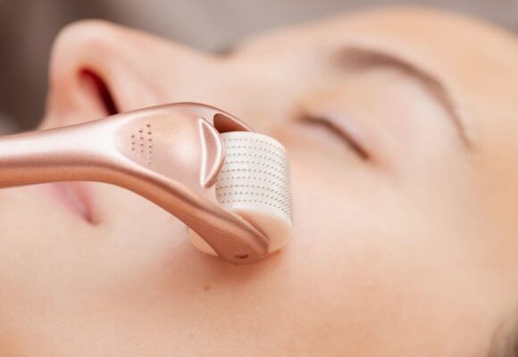 Microneedling : Boostez la Production de Collagène pour une Peau Plus Jeune et Saine